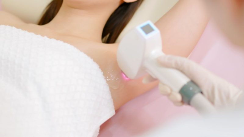 Advanced Skin Pigmentation Solutions and Whitening Treatments for Underarms in Singapore