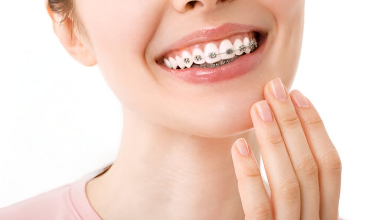 Proven Ways to Ease Discomfort from Braces